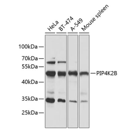 Western Blot - Anti-PIP4K2 beta Antibody (A90066) - Antibodies.com