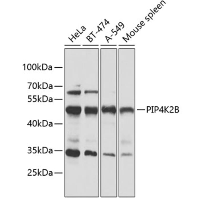 Western Blot - Anti-PIP4K2 beta Antibody (A90066) - Antibodies.com