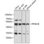 Western Blot - Anti-PIP4K2 beta Antibody (A90066) - Antibodies.com