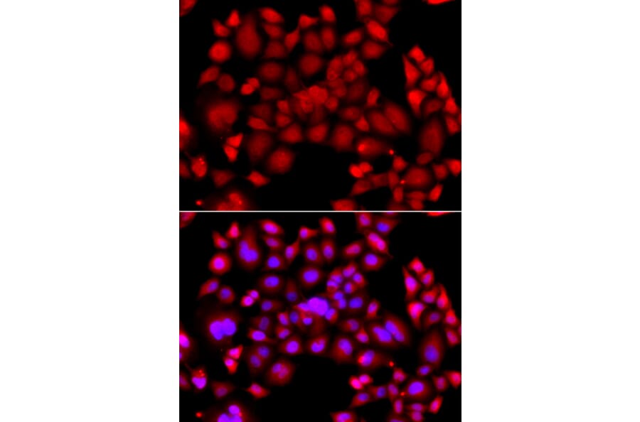 Immunofluorescence - Anti-PIP4K2 beta Antibody (A90066) - Antibodies.com