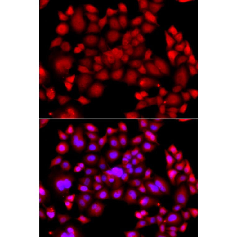 Immunofluorescence - Anti-PIP4K2 beta Antibody (A90066) - Antibodies.com