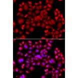 Immunofluorescence - Anti-PIP4K2 beta Antibody (A90066) - Antibodies.com