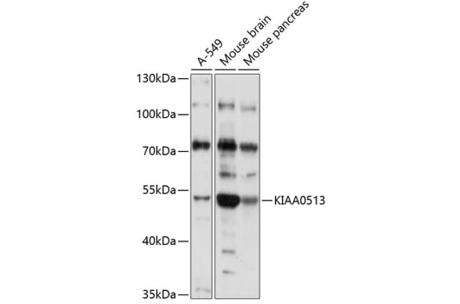 Western Blot - Anti-KIAA0513 Antibody (A90067) - Antibodies.com