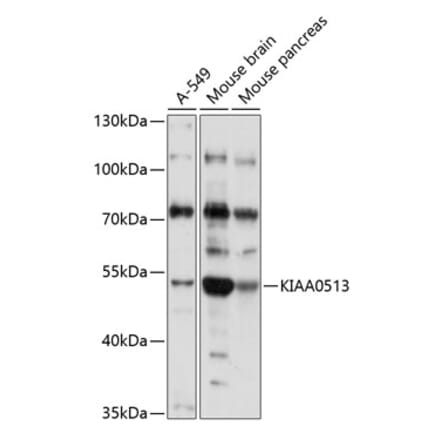 Western Blot - Anti-KIAA0513 Antibody (A90067) - Antibodies.com