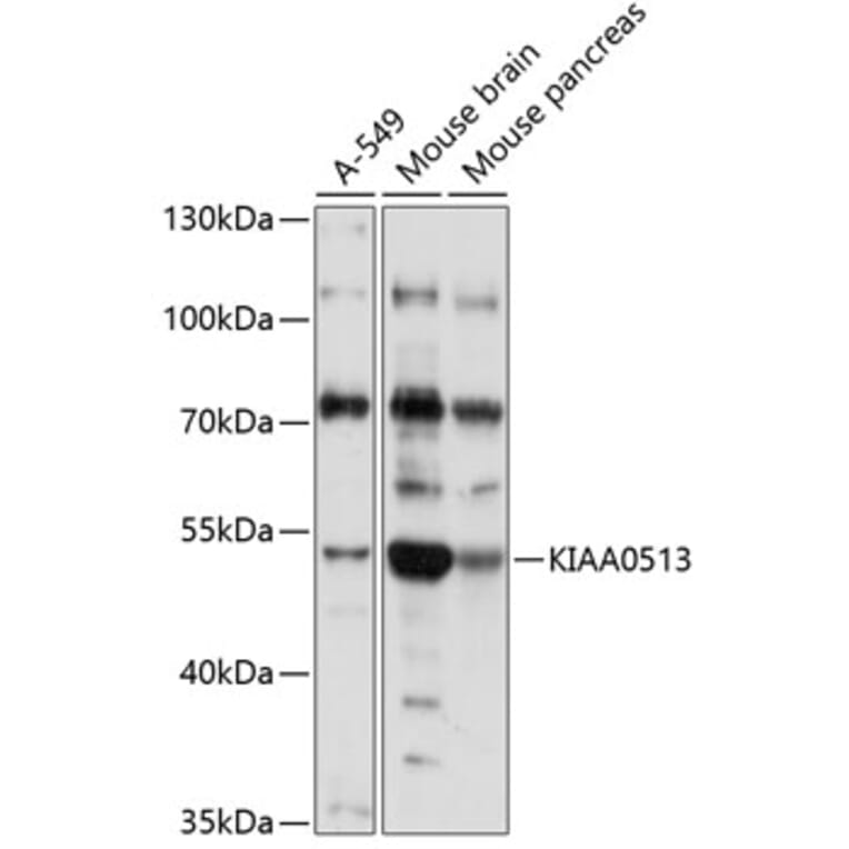 Western Blot - Anti-KIAA0513 Antibody (A90067) - Antibodies.com