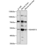Western Blot - Anti-KIAA0513 Antibody (A90067) - Antibodies.com