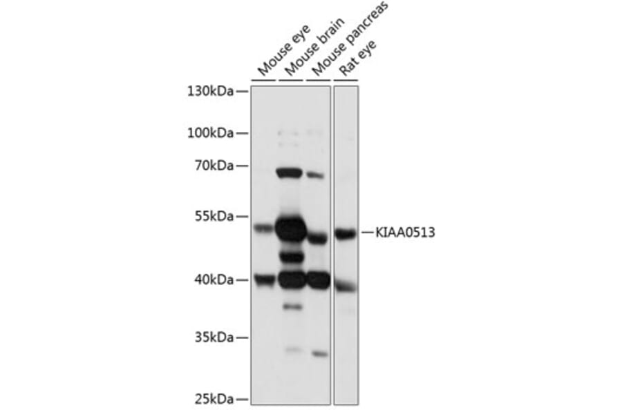 Western Blot - Anti-KIAA0513 Antibody (A90068) - Antibodies.com