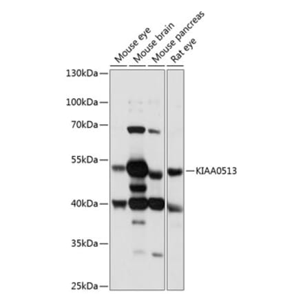 Western Blot - Anti-KIAA0513 Antibody (A90068) - Antibodies.com