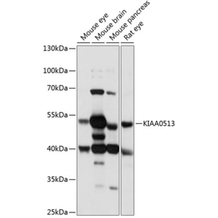 Western Blot - Anti-KIAA0513 Antibody (A90068) - Antibodies.com
