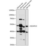 Western Blot - Anti-KIAA0513 Antibody (A90068) - Antibodies.com
