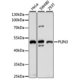 Western Blot - Anti-Perilipin 3 / TIP47 Antibody (A90070) - Antibodies.com