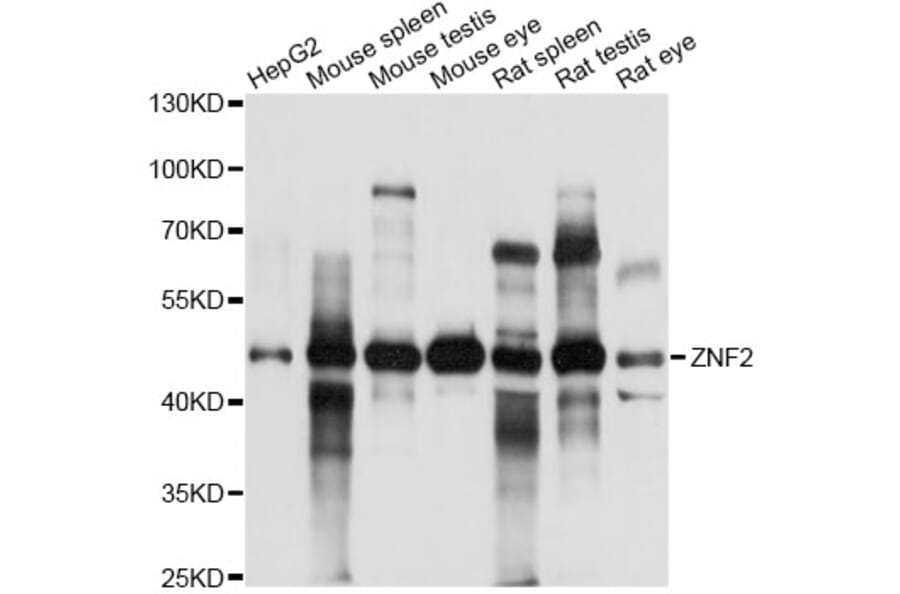 Western Blot - Anti-ZNF2 Antibody (A14381) - Antibodies.com