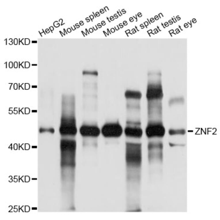 Western Blot - Anti-ZNF2 Antibody (A14381) - Antibodies.com