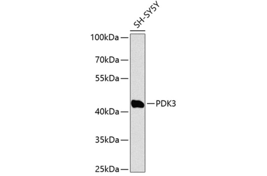 Western Blot - Anti-PDK3 Antibody (A90072) - Antibodies.com