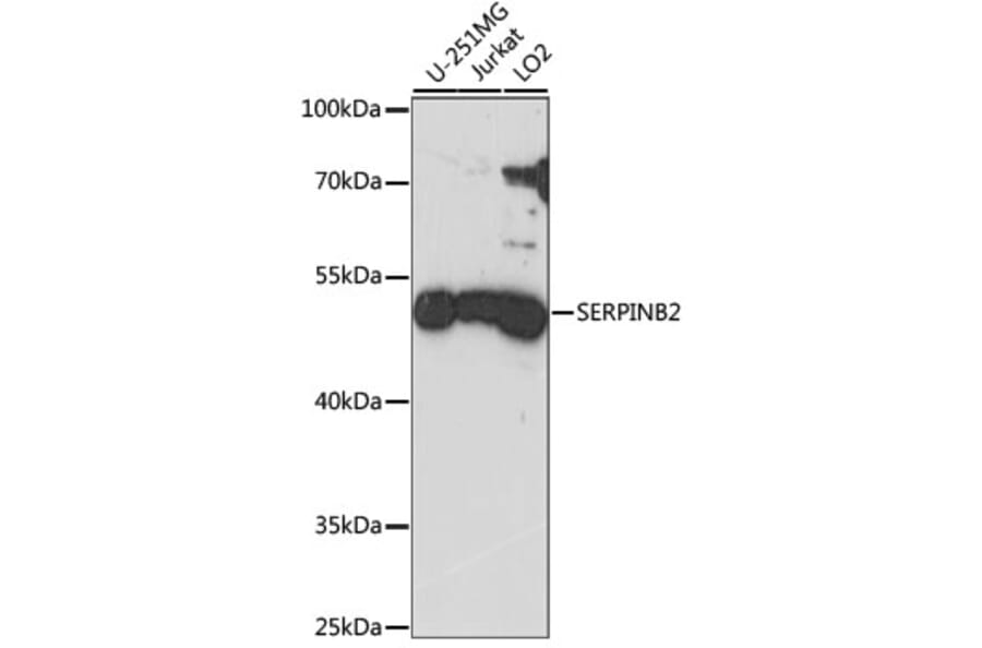Western Blot - Anti-SerpinB2/PAI-2 Antibody (A90073) - Antibodies.com