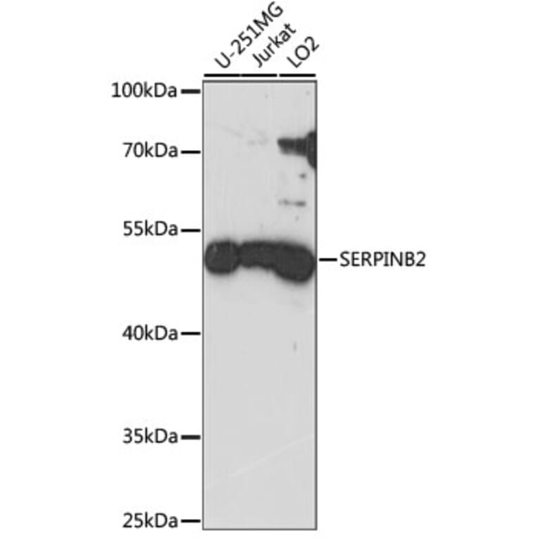 Western Blot - Anti-SerpinB2/PAI-2 Antibody (A90073) - Antibodies.com
