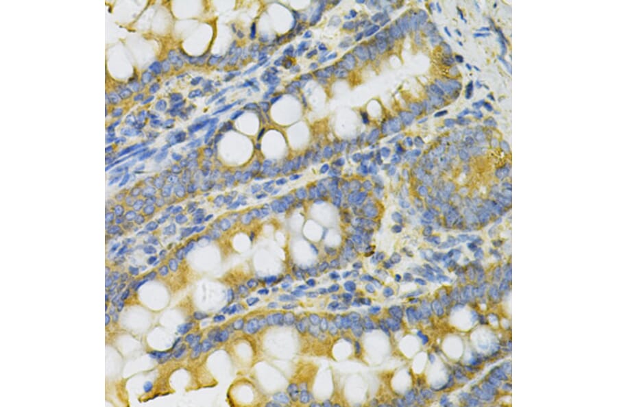 Immunohistochemistry - Anti-PGK1 Antibody (A90074) - Antibodies.com