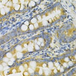 Immunohistochemistry - Anti-PGK1 Antibody (A90074) - Antibodies.com