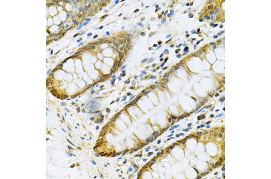Immunohistochemistry - Anti-PGK1 Antibody (A90074) - Antibodies.com