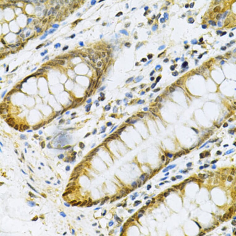 Immunohistochemistry - Anti-PGK1 Antibody (A90074) - Antibodies.com