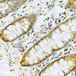 Immunohistochemistry - Anti-PGK1 Antibody (A90074) - Antibodies.com