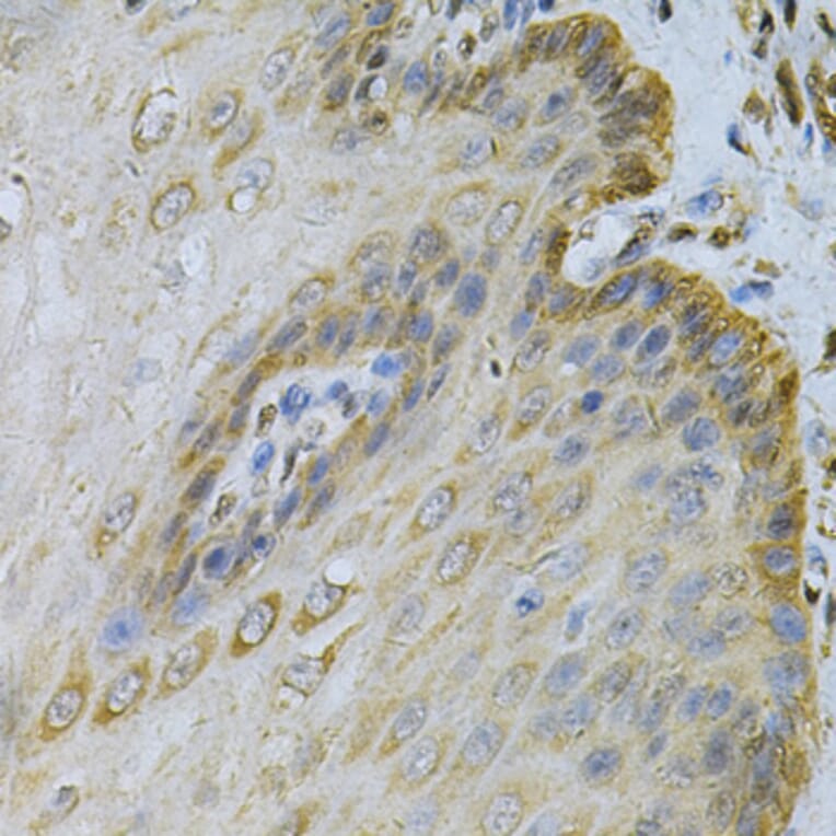 Immunohistochemistry - Anti-PGK1 Antibody (A90074) - Antibodies.com
