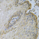 Immunohistochemistry - Anti-PGK1 Antibody (A90074) - Antibodies.com