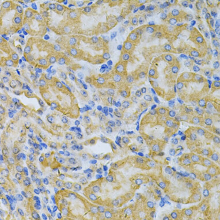 Immunohistochemistry - Anti-PGK1 Antibody (A90074) - Antibodies.com