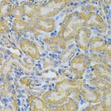 Immunohistochemistry - Anti-PGK1 Antibody (A90074) - Antibodies.com