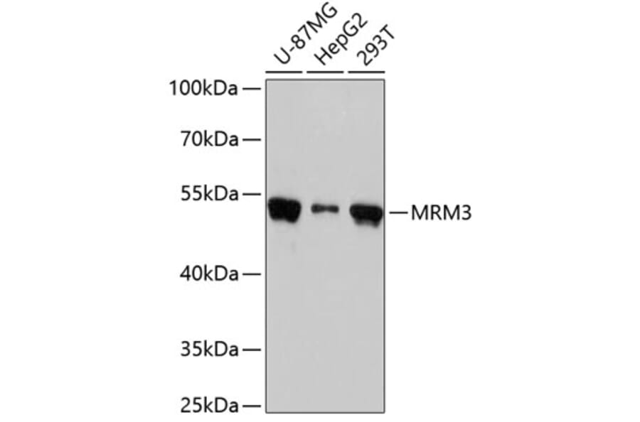 Western Blot - Anti-MRM3 Antibody (A90075) - Antibodies.com