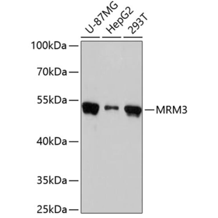 Western Blot - Anti-MRM3 Antibody (A90075) - Antibodies.com