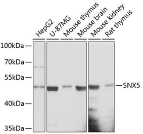 Western Blot - Anti-SNX5 Antibody (A90076) - Antibodies.com