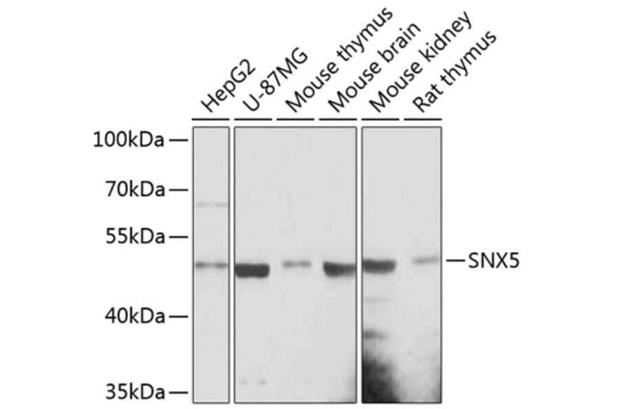 Western Blot - Anti-SNX5 Antibody (A90076) - Antibodies.com