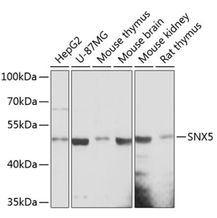 Western Blot - Anti-SNX5 Antibody (A90076) - Antibodies.com