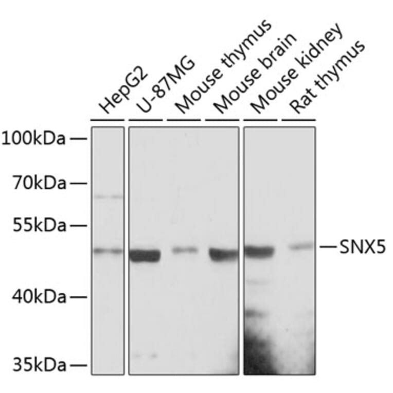 Western Blot - Anti-SNX5 Antibody (A90076) - Antibodies.com