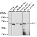 Western Blot - Anti-SNX5 Antibody (A90076) - Antibodies.com