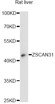 Western blot analysis of extracts of rat liver, using Anti-ZSCAN31 Antibody (A14290) at 1:3000 dilution.
Secondary antibody: Goat Anti-Rabbit IgG (H+L) (HRP) (AS014) at 1:10,000 dilution.
Lysates / proteins: 25µg per lane.
Blocking buffer: 3% non-fat dry milk in TBST.
Detection: ECL Basic Kit (RM00020).
Exposure time: 90s.