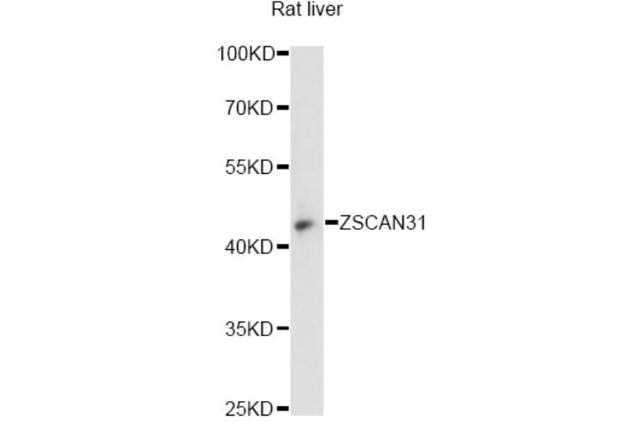 Western Blot - Anti-ZSCAN31 Antibody (A14290) - Antibodies.com