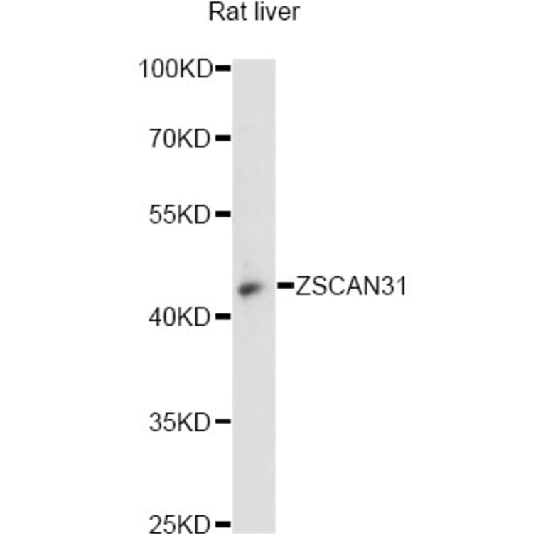 Western Blot - Anti-ZSCAN31 Antibody (A14290) - Antibodies.com