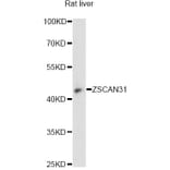 Western Blot - Anti-ZSCAN31 Antibody (A14290) - Antibodies.com