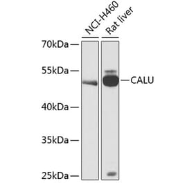 Western Blot - Anti-Calumenin Antibody (A90078) - Antibodies.com