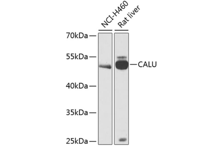 Western Blot - Anti-Calumenin Antibody (A90078) - Antibodies.com