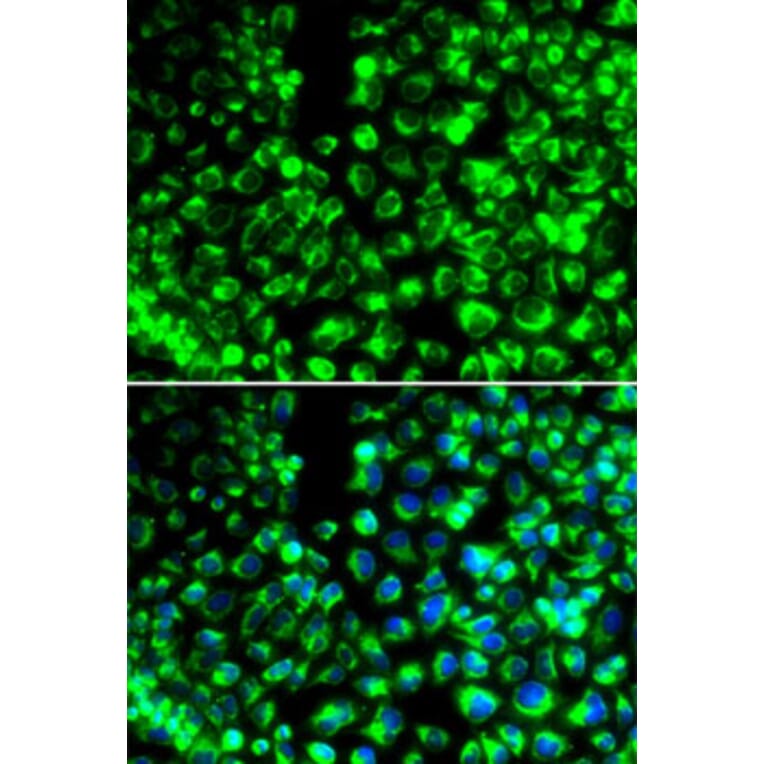 Immunofluorescence - Anti-Calumenin Antibody (A90078) - Antibodies.com