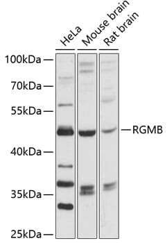 Western blot analysis of extracts of various cell lines, using Anti-RGMB Antibody (A12859) at 1:3000 dilution.
Secondary antibody: Goat Anti-Rabbit IgG (H+L) (HRP) (AS014) at 1:10,000 dilution.
Lysates / proteins: 25µg per lane.
Blocking buffer: 3% non-fat dry milk in TBST.
Detection: ECL Basic Kit (RM00020).
Exposure time: 30s.