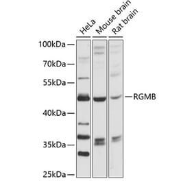 Western Blot - Anti-DRAGON Antibody (A90079) - Antibodies.com