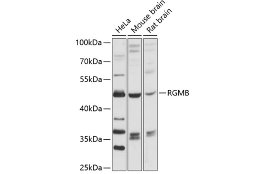 Western Blot - Anti-DRAGON Antibody (A90079) - Antibodies.com