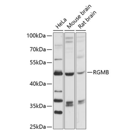 Western Blot - Anti-DRAGON Antibody (A90079) - Antibodies.com