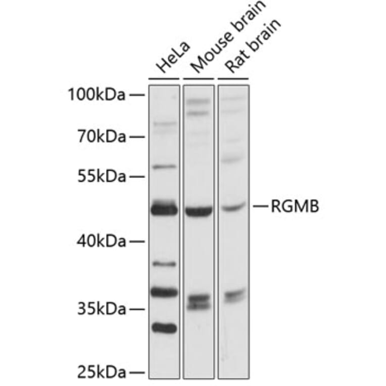 Western Blot - Anti-DRAGON Antibody (A90079) - Antibodies.com