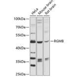 Western Blot - Anti-DRAGON Antibody (A90079) - Antibodies.com