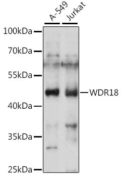 Western blot analysis of extracts of various cell lines, using Anti-WDR18 Antibody (A15875) at 1:1,000 dilution.
Secondary antibody: Goat Anti-Rabbit IgG (H+L) (HRP) (AS014) at 1:10,000 dilution.
Lysates / proteins: 25µg per lane.
Blocking buffer: 3% non-fat dry milk in TBST.
Detection: ECL Basic Kit (RM00020).
Exposure time: 120s.